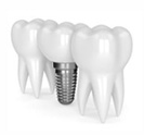 implants dentaires - Dental Danos
